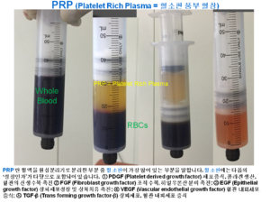 PRP processing