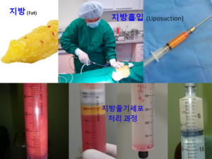 processing of adipose tissue for stem cells