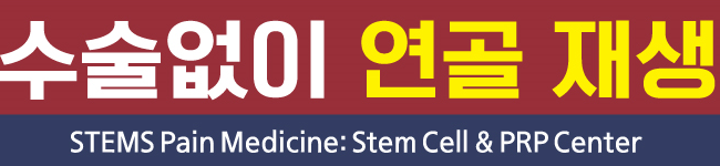 스템스 줄기세포 통증내과